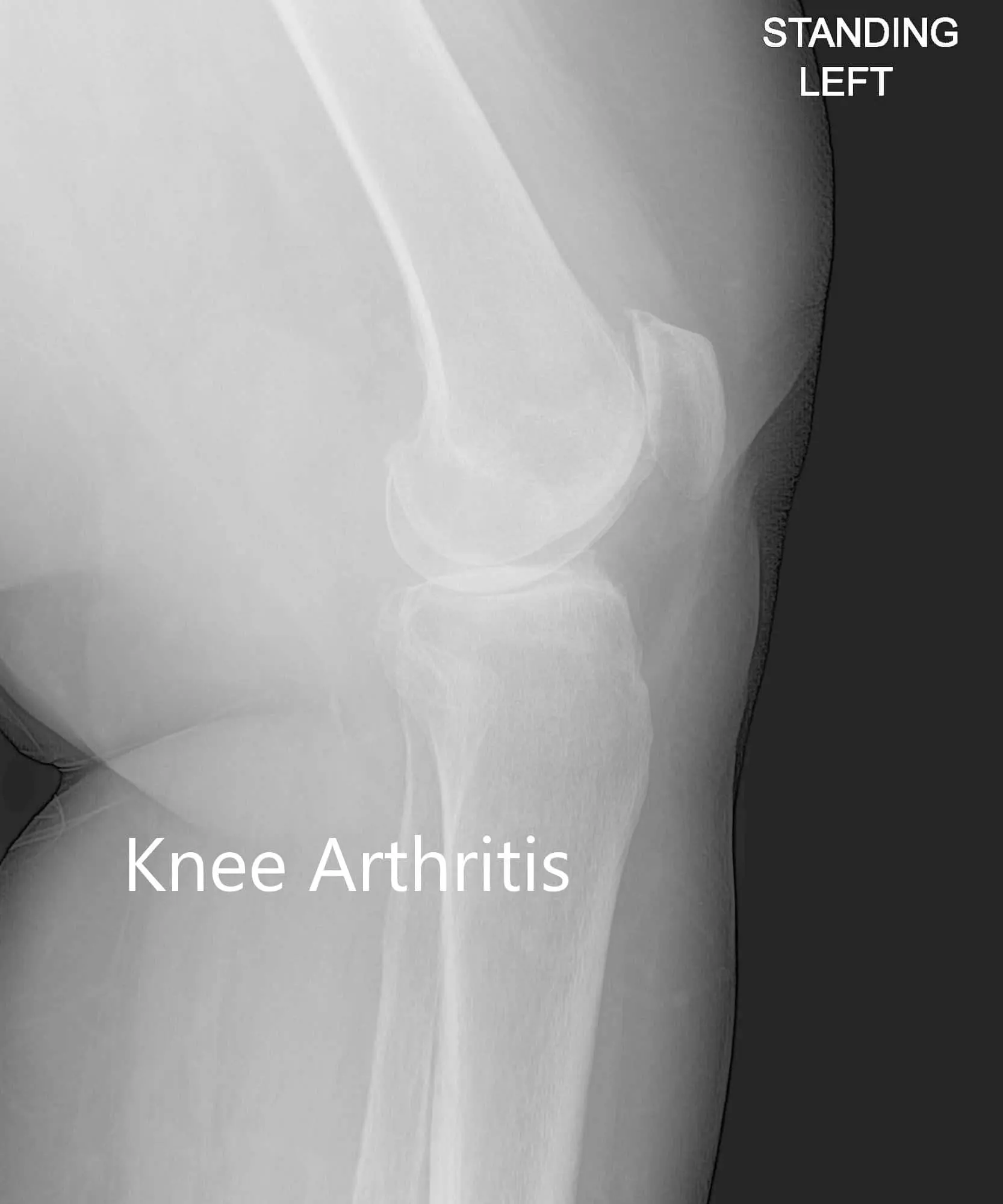 Anteroposterior and lateral view of the left knee - img 2