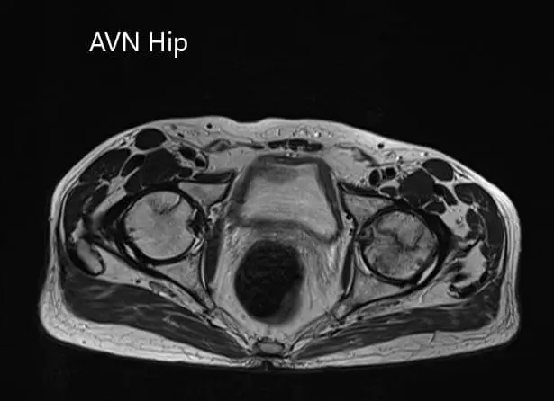 Axial sections of and T1WI
