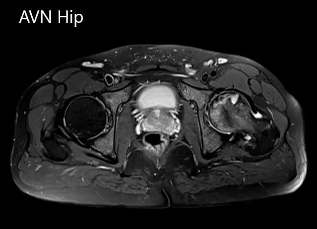 Axial sections of the T2WI.