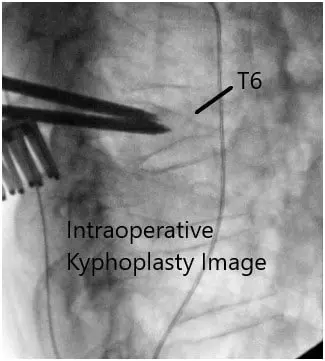Intraoperative fluoroscopy images