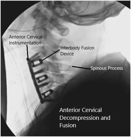 Intraoperative fluoroscopic images 2