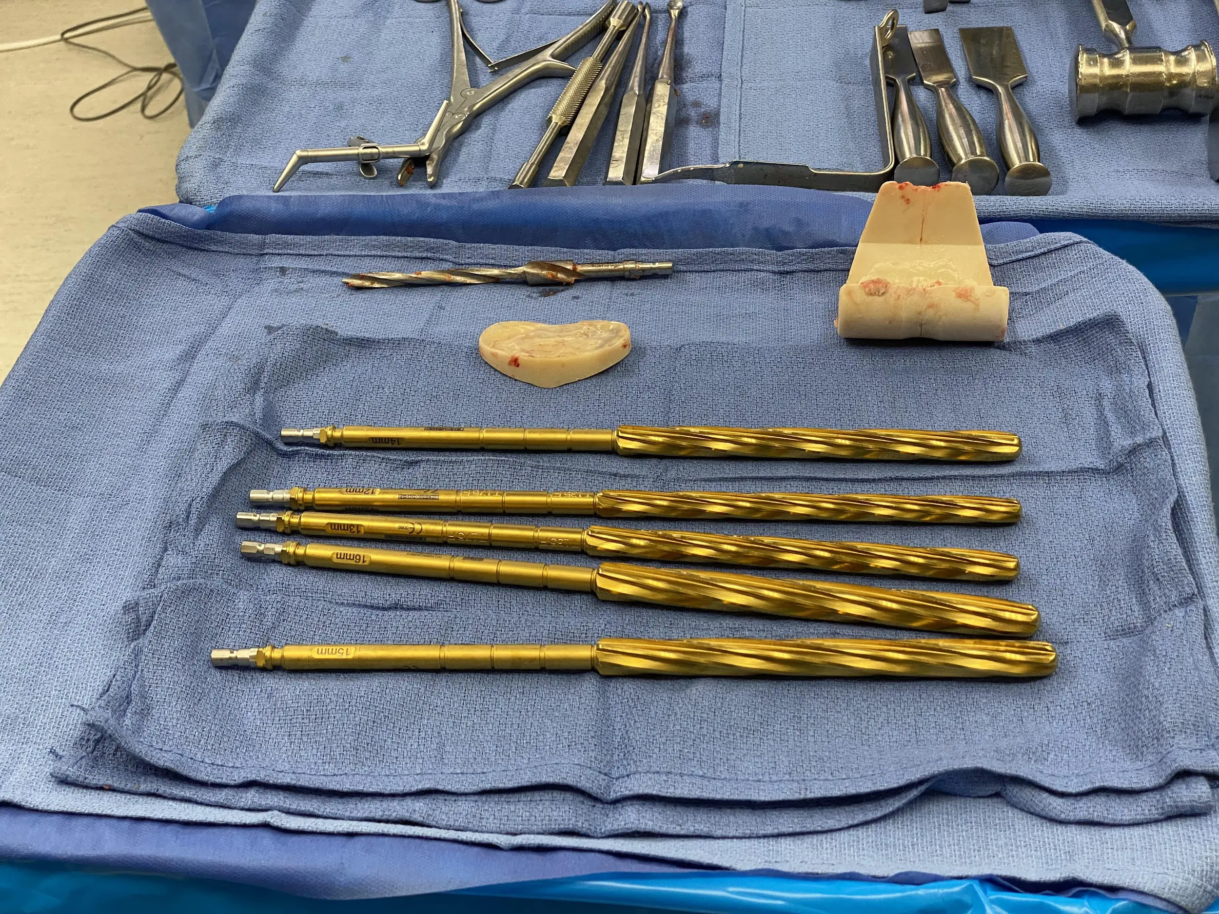 Removed articulating cement spacer and reamers