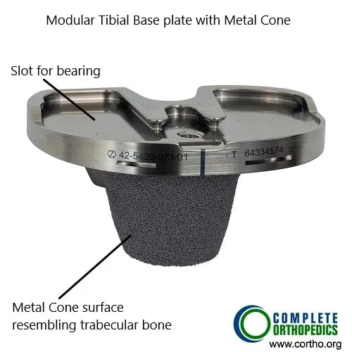 odular tibial component with metaphyseal cone