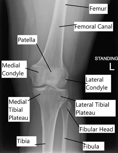 X-ray showing knee anatomy.