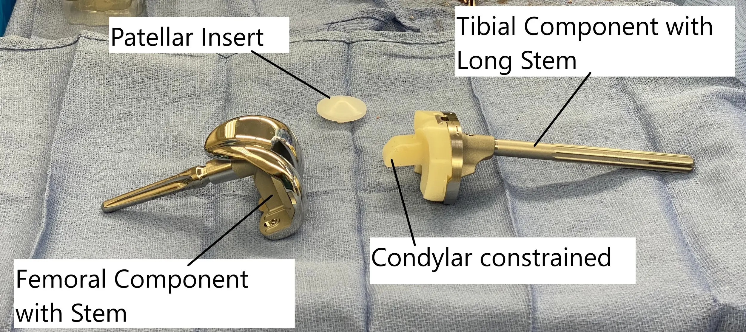 Revision knee replacement implants (Condylar constrained)