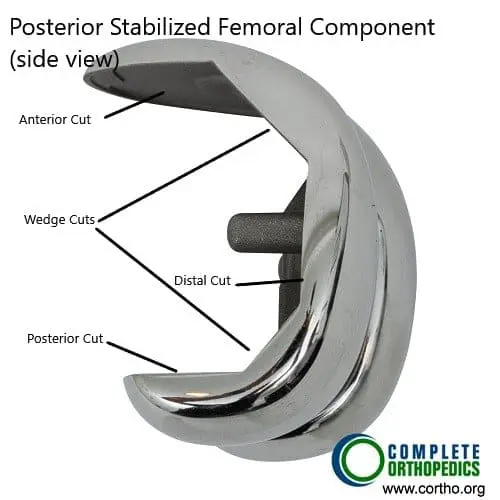 Femoral Component (side view)