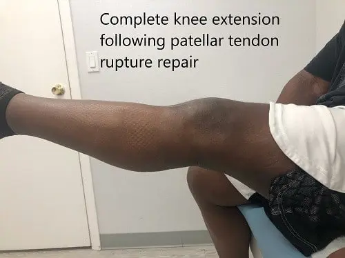 Postoperative images at 2 months follow up.