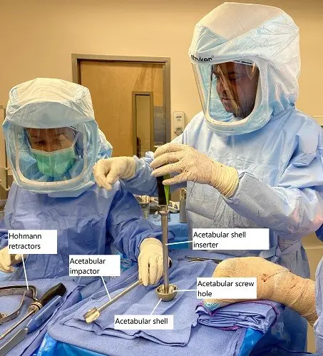 Intraoperative image showing loading of the prosthetic acetabular shell.