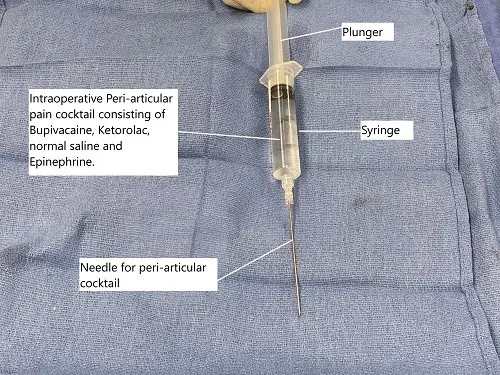 Intraoperative cocktail for peri-articular injection used for pain control after the surgery.