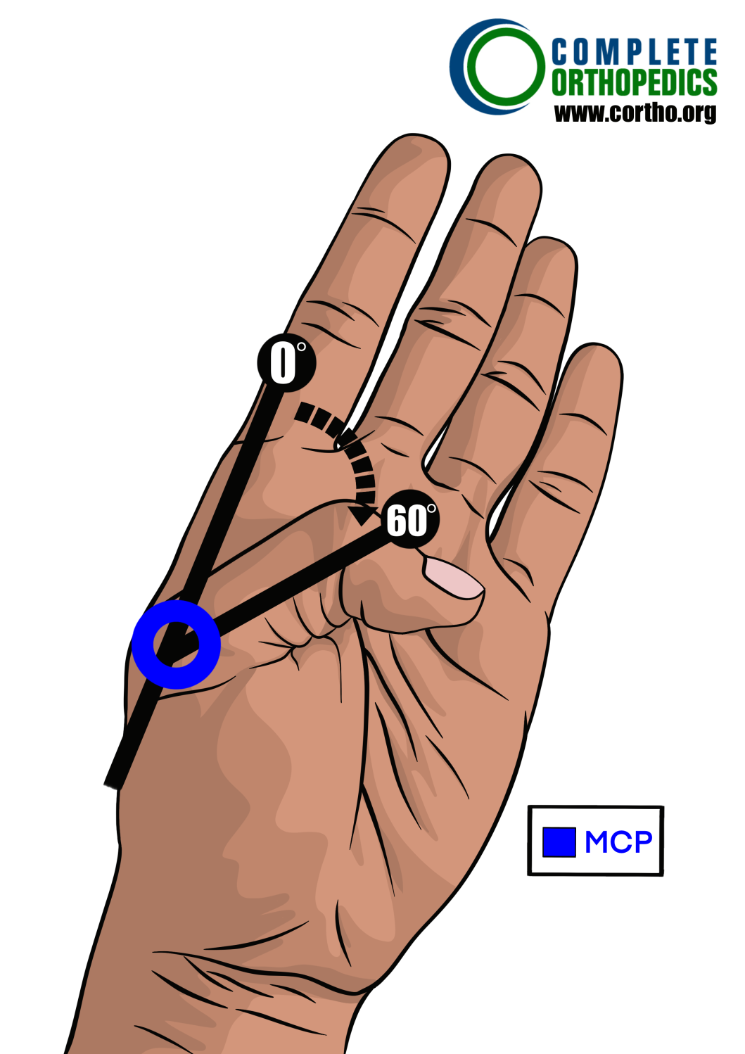 metacarpophalangeal joint of thumb to evaluate loss of motion to calculate scheduled loss of use for workers compensation patient