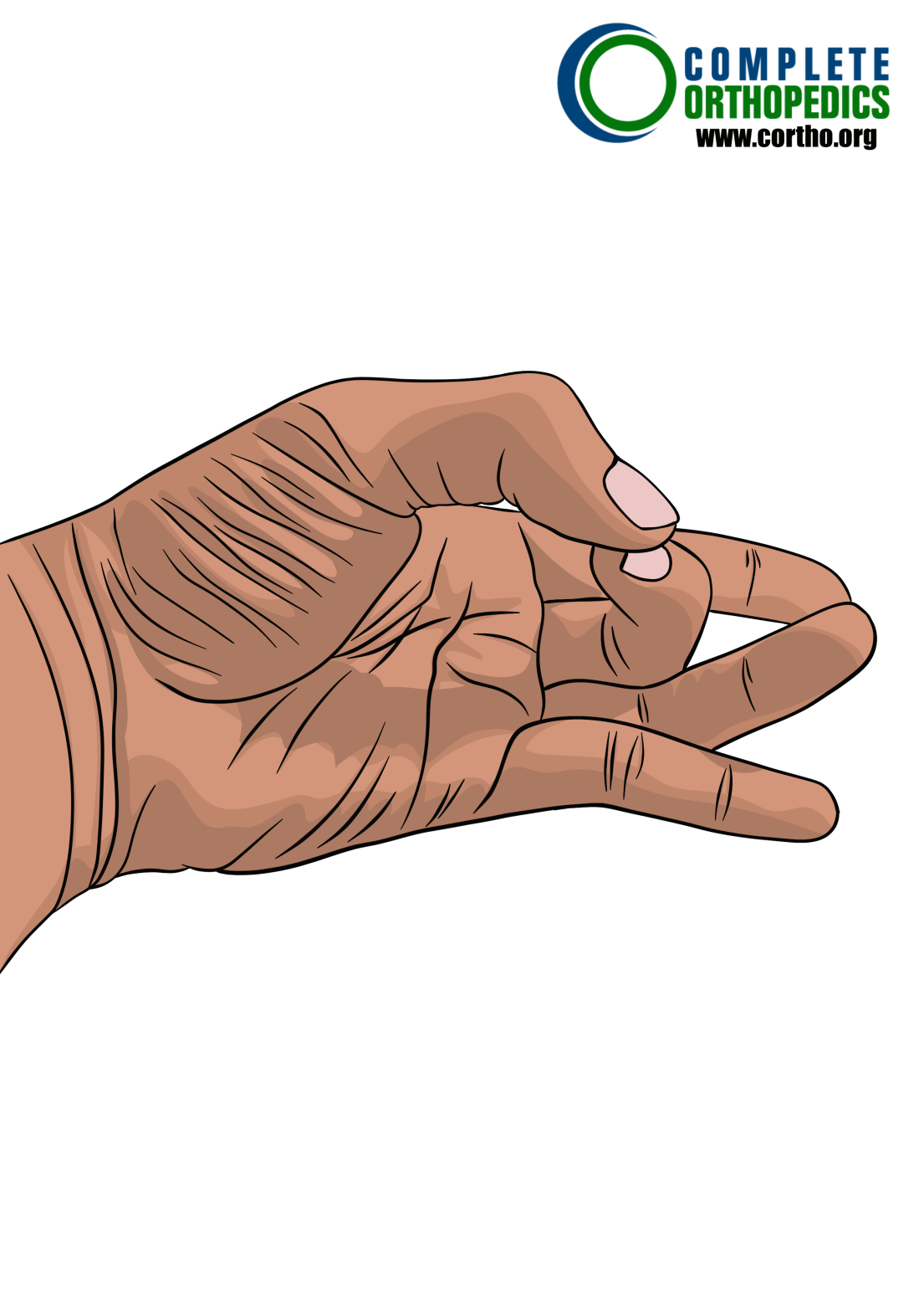 Isolated-Opposition of thumb to evaluate loss of motion to calculate scheduled loss of use for workers compensation patient