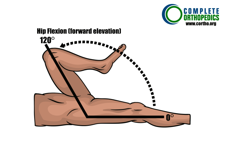 Hip-Flexion to evaluate loss of motion to calculate scheduled loss of use for workers compensation patient