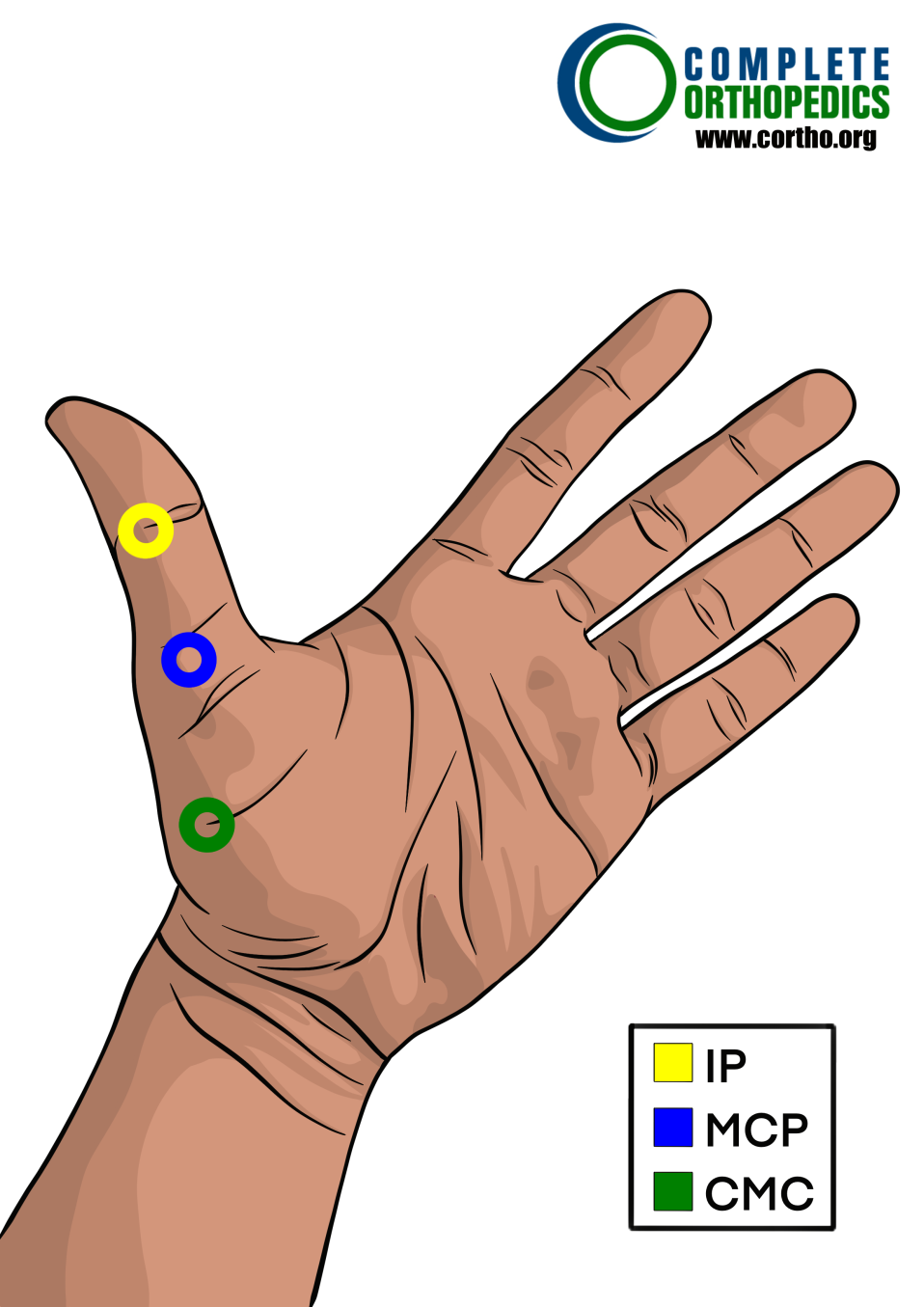 metacarpophalangeal joint and proximal Interphalangeal Distal Interphalangeal of thumb to evaluate loss of motion to calculate scheduled loss of use for workers compensation patient