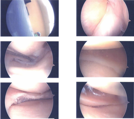 Intraoperative Images
