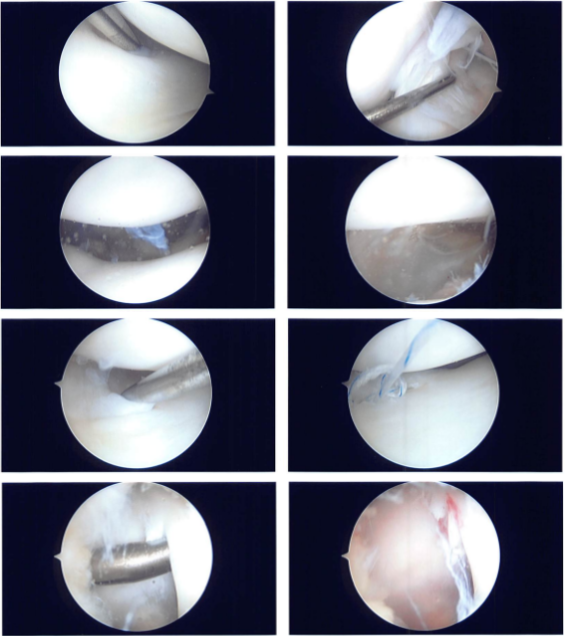 Intraoperative Images