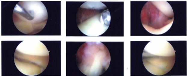 Intraoperative Images