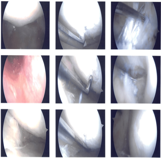 Intraoperative images