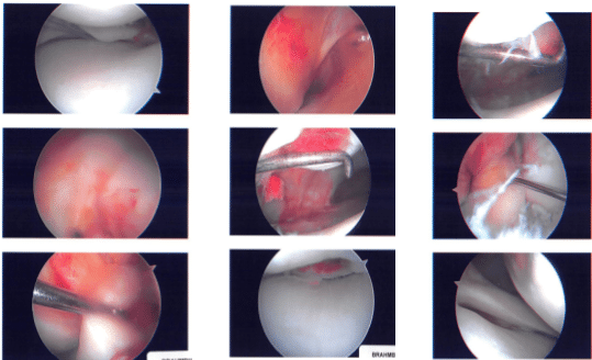 Intraoperative images