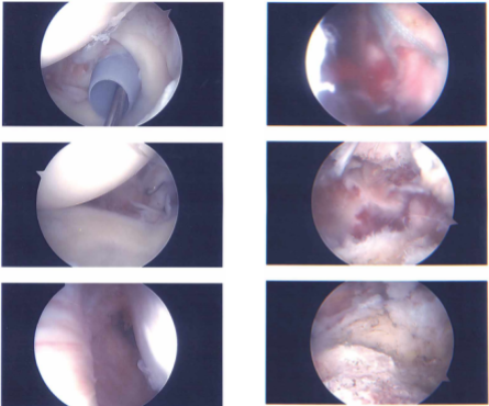 Intraoperative report