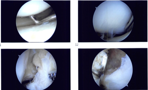 Introperative images