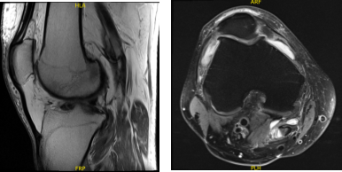 cussed the treatment options and o