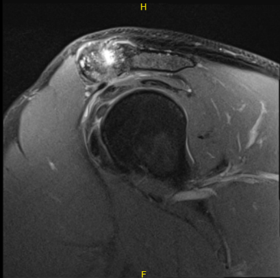 Intraoperative Arthroscopy Images