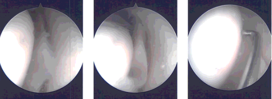 Intraoperative images