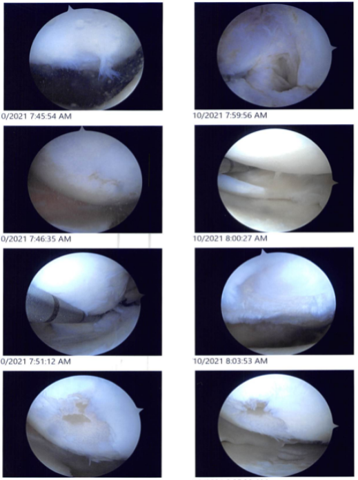 Intraoperative images