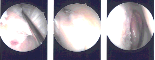 Intraoperative images