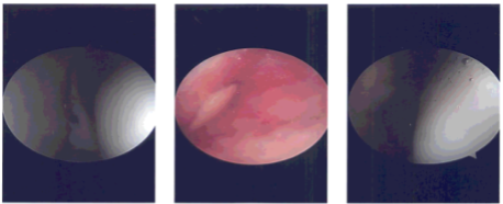 Intraoperative photo