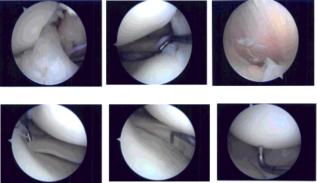 Intraoperative photo