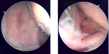 Intraoperative Images
