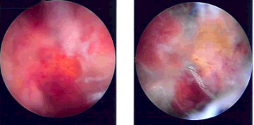 Intraoperative Images