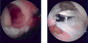Intraoperative Images